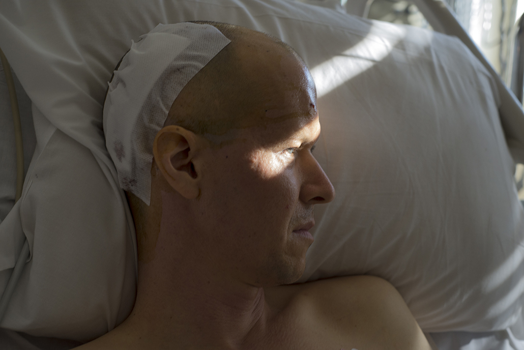 recovering from brain surgery